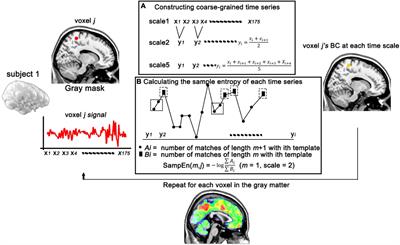 Alteration in Functional Magnetic Resonance Imaging Signal Complexity Across Multiple Time Scales in Patients With Migraine Without Aura